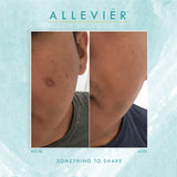 Allevier by Anuar Zain