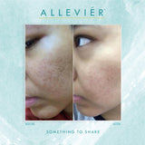 Allevier by Anuar Zain