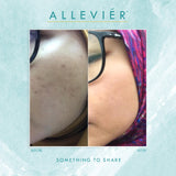 Allevier by Anuar Zain