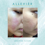 Allevier by Anuar Zain