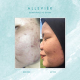 Allevier by Anuar Zain