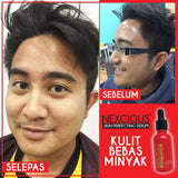 Nexcious Red