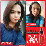 Nexcious Red