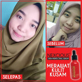 Nexcious Red