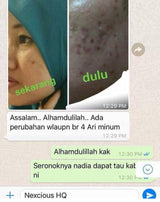Nexcious Advance - Nak Kulit Lebih Putih - 4 Free Gifts